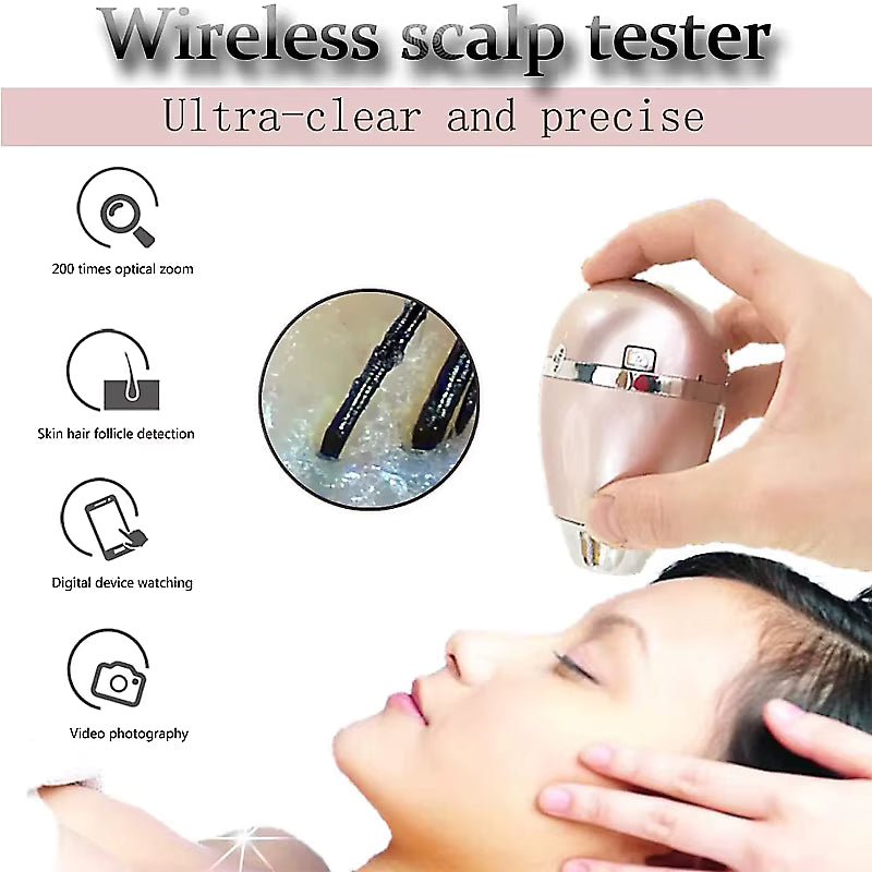 DermalSmart Follicle & Skin HD Analyzer